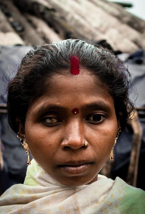 single-eye-punit