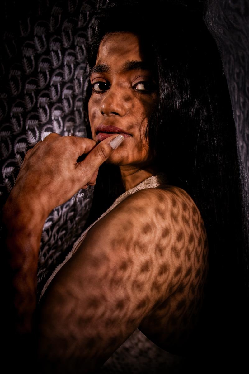 on the girl's face, shadow passes through the lace