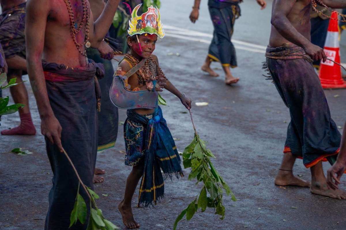 a young boy dance with broken hand
